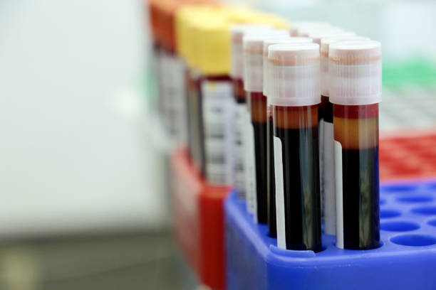 frascos de sangue no laboratório médico - analyzing biology blue clinic - fotografias e filmes do acervo