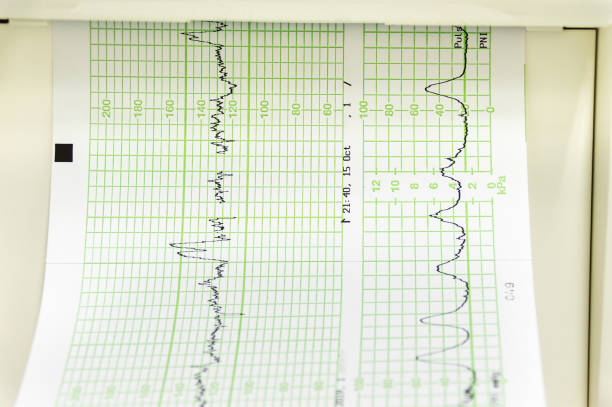 Electrocardiogram in paper form, closeup