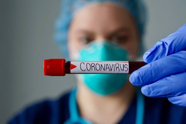 медсестра в респираторной маске, держащая положительный результат анализа крови на новый быстро распространяющийся коронавирус, происход - specimen holder фотографии стоковые фото и изображения