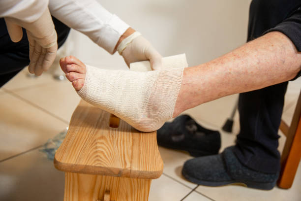 assistente domestico che aiuta la donna anziana a fasciarsi la caviglia ferita - foto di repertorio - twisted ankle immagine foto e immagini stock