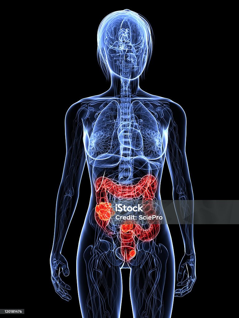 colon Krebs - Lizenzfrei Anatomie Stock-Foto