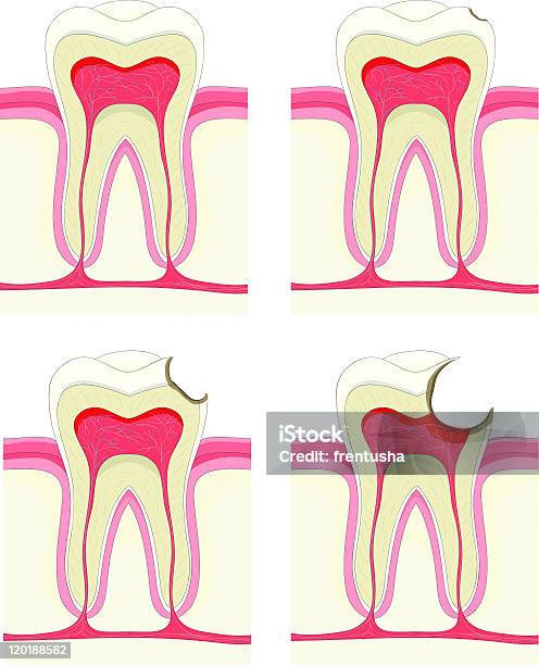 Dente - Arte vetorial de stock e mais imagens de Apodrecer - Apodrecer, Bicicleta, Branco