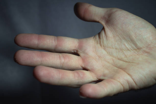 istock Hand with small calluses after a hard session on the climbing gym 1201910145