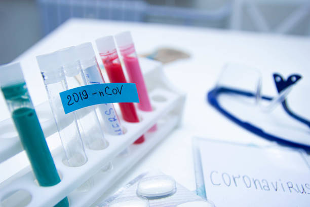 tubo de teste coronavírus, experimentos em busca de uma vacina. - analyzing biology blue clinic - fotografias e filmes do acervo