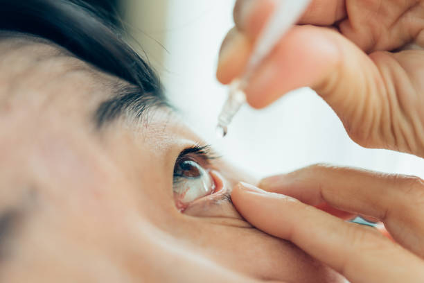 istock Woman use eye drop, artificial tears to the eye 1202005514