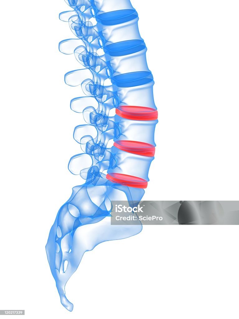 A diagram showing the human spinal cord  painful spine illustration Backache Stock Photo