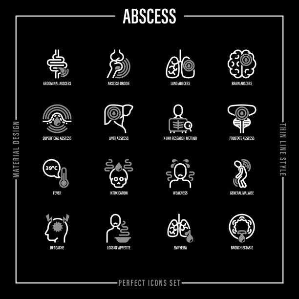 ilustrações de stock, clip art, desenhos animados e ícones de abscess thin line icons set. joint, abdominal, brain, intestine, lung, liver, superficial abscess, x-ray research method, intoxication, fever, general malaise, empyema. vector illustration. - intoxication