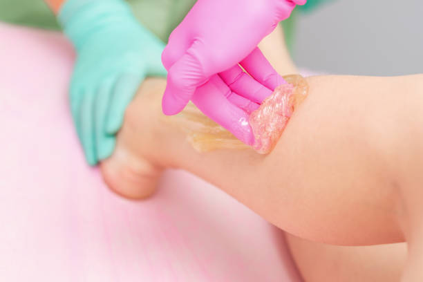 istock Epilation with liquid sugar on legacies. 1202344354