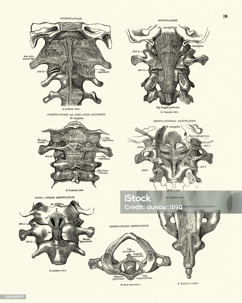 Atloid Victorian Anatomical Drawing Occipitoatloid Occipito Axoid Atloaxoid ...