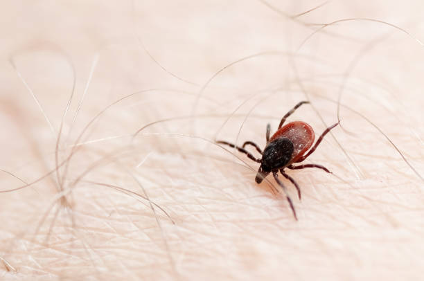 istock Closeup of tick on human skin surface 1202465856