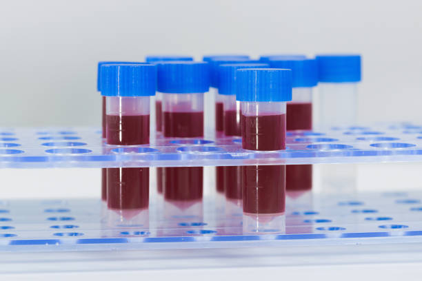 istock blood probes in a tube rack 1202487553