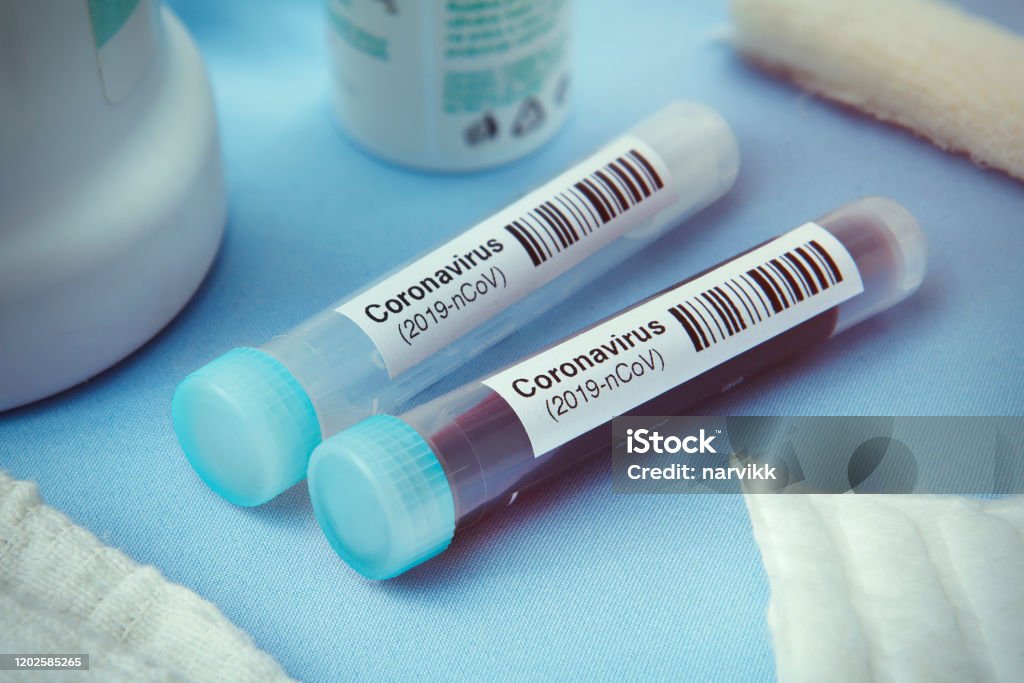 Coronavirus test Detail of coronavirus test tubes Medical Test Stock Photo