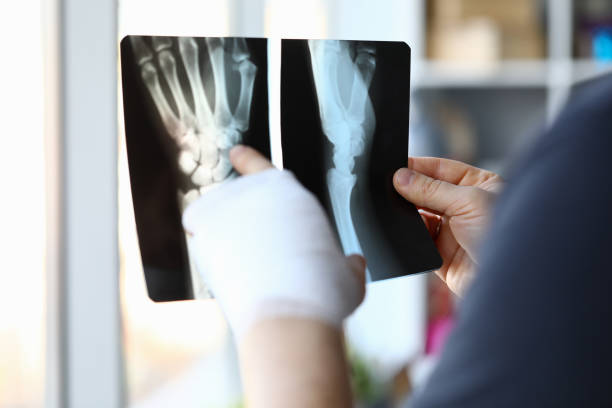 la main bandée mâle retient le plan rapproché d'image de rayon x - physical injury bandage wound cast photos et images de collection