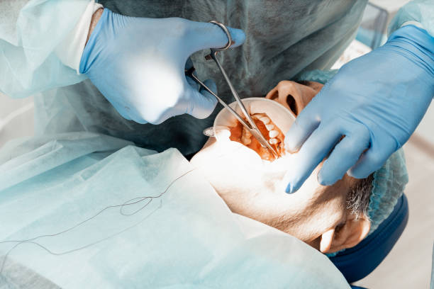 Patient and dentist during implant placement operation. Real operation. Tooth extraction, implants. Professional uniform and equipment of a dentist. Healthcare Equipping a doctorâs workplace. Dentistry. paciente y dentista durante la operación de colocación del implante. funcionamiento real. extracción de dientes, implantes. uniforme profesional y equipo de un dentista. equipo de atención médica para el lugar de trabajo del médico. odontología
