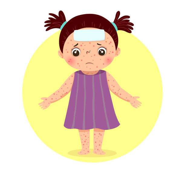 Vector illustration of a little girl with rashes all over her body from measles. Health Problems concept. Vector illustration of a little girl with rashes all over her body from measles. Health Problems concept. measles illustrations stock illustrations