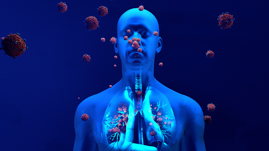 Gotas infectadas con un aerosol de virus en el aire, pulmones humanos infectados por el coronavirus o por virus, Infección respiratoria causada por un virus. Sars photo
