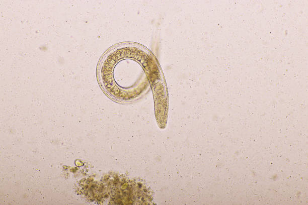 istock Strongyloides stercoralis or threadworm in human stool 1202974349