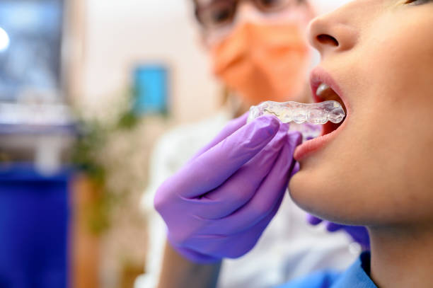 Wearing orthodontic silicone trainer Dentist hand showing an implant to a patient in an office mouthguard stock pictures, royalty-free photos & images