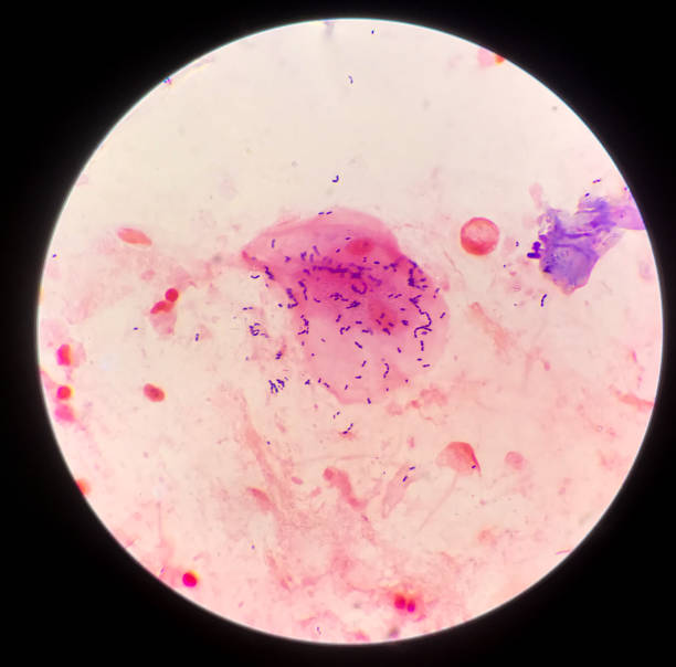 istock Gram positive bacilli on red background from specimen sputum. 1203136869