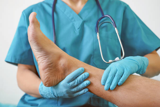 le mani del medico nei guanti tengono un piede con le dita dei piedi, infettato da funghi delle unghie per l'esame e la diagnosi. - senior male immagine foto e immagini stock