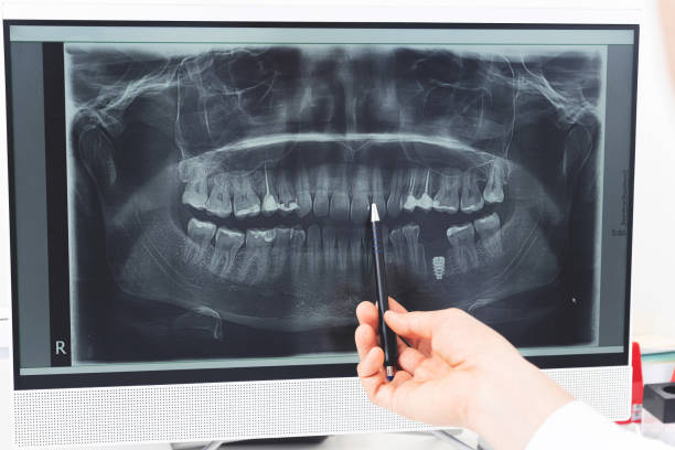 istock Panoramic dental x-ray of human jaw 1203263371