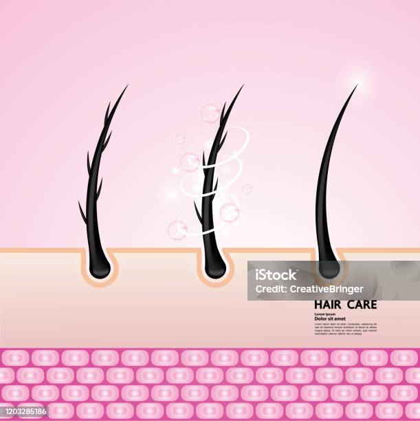 Hair Problem Animation Hair Problem And Hair Protect And Care Technology Concept Vector ...