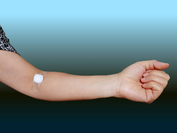 istock Arm with Cotton Pad After Blood Collection Isolated on Blue 1203513162
