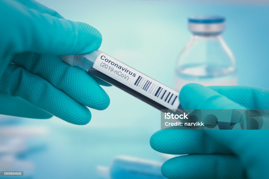 Coronavirus test Detail of coronavirus test sample COVID-19 Stock Photo