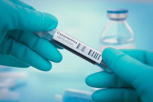 Detail of coronavirus test sample