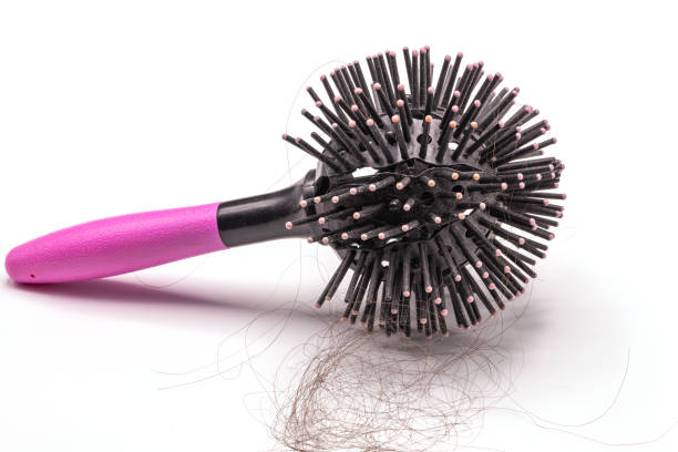 istock Close up hairs loss fall in comb isolate on white background. 1203566572