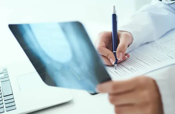 Photo of Close up of female doctor holding x-ray or roentgen image and making notes in medical form.