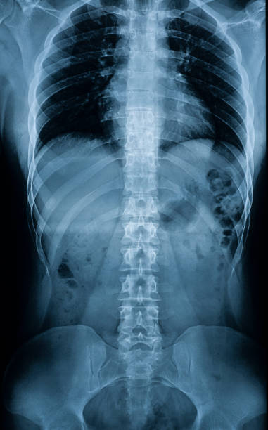 röntgenaufnahme eines mannes"u2019s körper - wirbelsäule, beckenknochen, rippen, innere organe - oberkörper stock-fotos und bilder