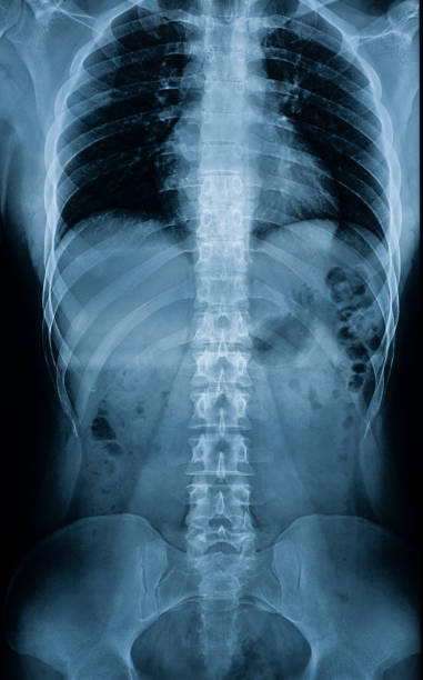 radiografía de un cuerpo de un hombre"u2019s - columna vertebral, huesos pélvicos, costillas, órganos internos - torso fotografías e imágenes de stock