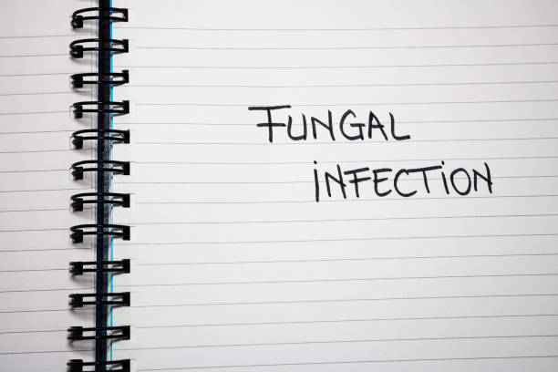istock Fungal infection handwriting  text on paper, on office agenda. Copy space. 1203751590