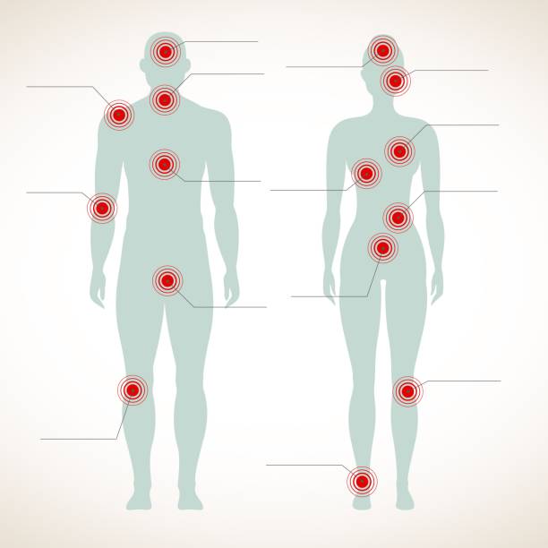 infografis nyeri. siluet manusia tubuh pria dan wanita dengan migrain dan perut menyakiti simbol vektor yang menyakitkan - laki laki ilustrasi ilustrasi stok