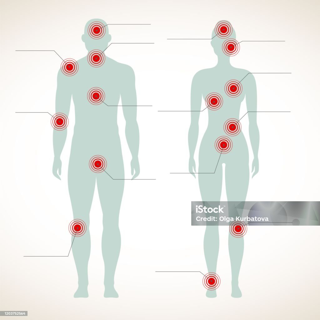 Ağrı infografik. Migren ve karın ile erkek ve kadın vücudunun insan silueti acı semboller vektör zarar - Royalty-free İnsan Vücudu Vector Art