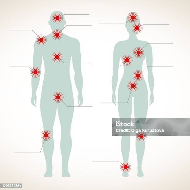 Pain Infographic Human Silhouette Of Man And Woman Body With Migraine And Belly Hurt Painful Symbols Vector Stock Illustration - Download Image Now