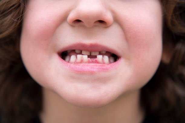 istock mouth of a small child 1203768254