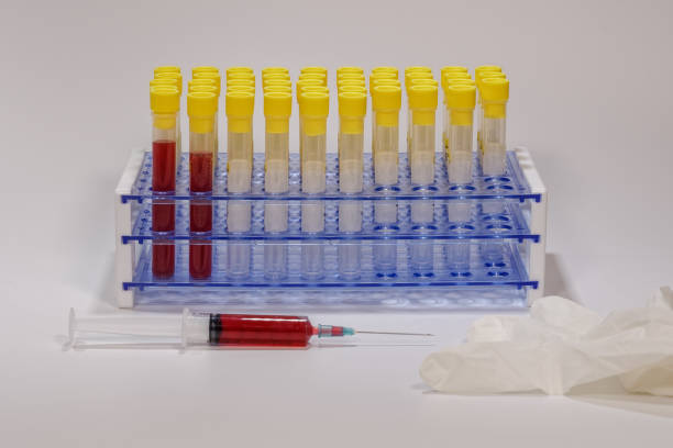 istock Clinical tests with laboratory testing medical equipment and a syringe with blood next to protective white glove. 1204001471