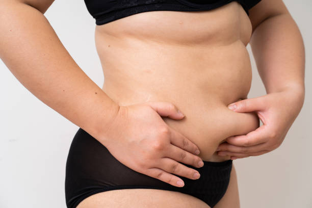 istock Overweight women belly black underwear 1204088140