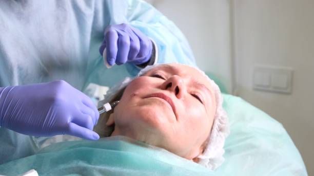 mittelalte frau 50 immer eine hebeinjektion einer injektion von hyaluronsäure in das gesicht von einem arzt kosmetologe. kosmetisches verfahren. nahaufnahme - healthcare and medicine beauty spa botox injection hyaluronic acid stock-fotos und bilder