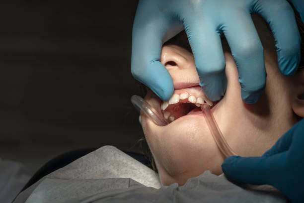 istock Child having a dental filling operation. 1204275928