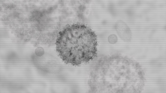 Advance head up display of electron microscope scanning airborne virus outbreak showing the anatomy of the virus in close up details