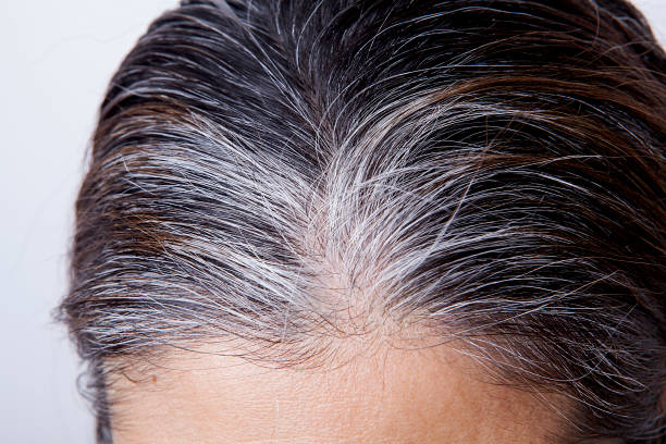 istock Young woman with white hair problem 1204409463