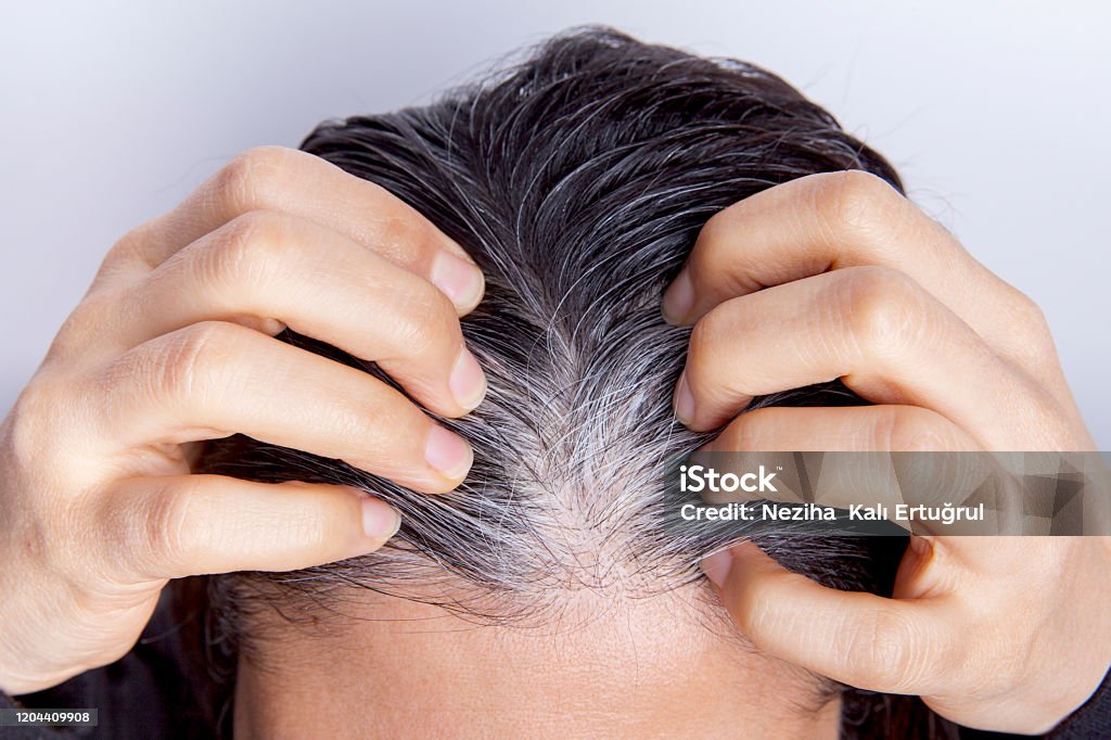 Young Woman With White Hair Problem Stock Photo - Download Image Now - White  Hair, Young Adult, Adult - iStock