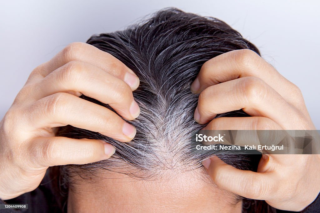 Young Woman With White Hair Problem Stock Photo - Download Image Now - White Hair, Young Adult, Adult - iStock Young Woman With White Hair Problem Stock Photo - Download Image Now - White Hair, Young Adult, Adult - iStock