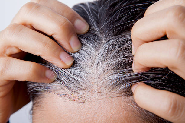 mujer joven con problema de pelo blanco - white hair fotografías e imágenes de stock