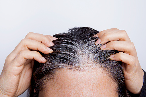 Young Woman With White Hair Problem Stock Photo - Download Image Now - White Hair, Young Women, Adult - iStock Young Woman With White Hair Problem Stock Photo - Download Image Now - White Hair, Young Women, Adult - iStock