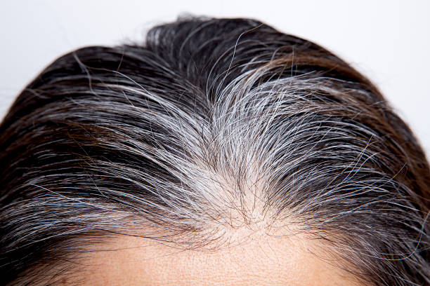 istock Young woman with white hair problem 1204413027