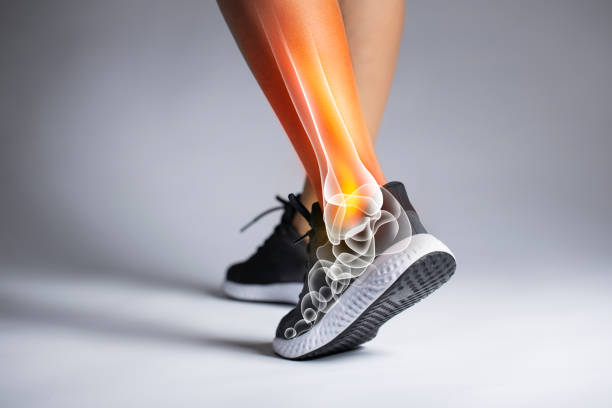 ankle pain in detail - sports injuries concept - orthopedics imagens e fotografias de stock